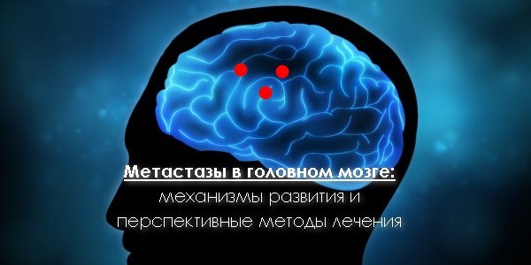 Лечение метастазов мозга